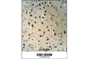 Immunohistochemistry (IHC) image for anti-Eukaryotic Translation Initiation Factor 2C, 1 (EIF2C1) antibody (ABIN2158663)