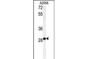C11orf46 antibody  (C-Term)