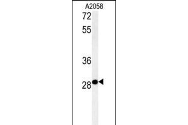 C11orf46 antibody  (C-Term)