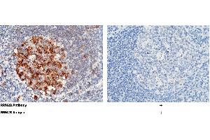 Image no. 2 for anti-Ribonucleotide Reductase M2 B (TP53 Inducible) (RRM2B) (AA 1-351) antibody (ABIN1999943)