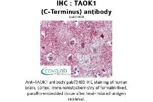 Image no. 1 for anti-TAO Kinase 1 (TAOK1) (C-Term) antibody (ABIN1739898)