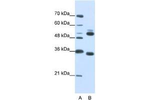 WB Suggested Anti-WDR6  Antibody Titration: 0.