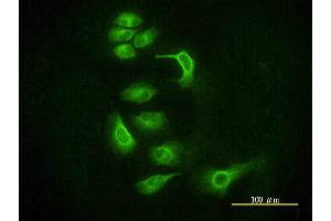 Image no. 2 for anti-Argonaute 2 (AGO2) (AA 1-377) antibody (ABIN565346)