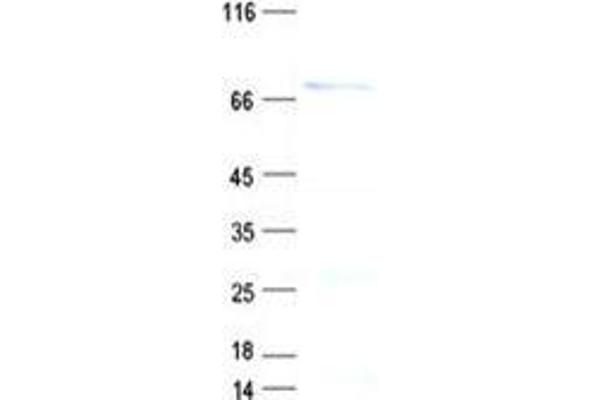 PPP2R3B Protein (Regulatory Subunit B) (His tag)