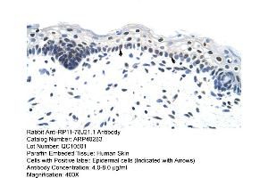 Image no. 2 for anti-Heterogeneous Nuclear Ribonucleoprotein A1-Like 2 (HNRNPA1L2) (N-Term) antibody (ABIN2778721)