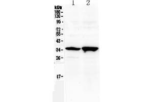 Image no. 1 for anti-Sine Oculis-Related Homeobox 3 (SIX3) (AA 1-32), (N-Term) antibody (ABIN5518955)