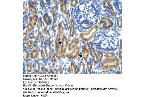 Image no. 2 for anti-Hematopoietic Cell-Specific Lyn Substrate 1 (HCLS1) (N-Term) antibody (ABIN2777503)