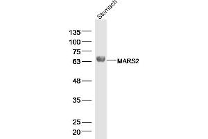 Image no. 1 for anti-Methionyl-tRNA Synthetase 2, Mitochondrial (MARS2) (AA 31-130) antibody (ABIN5675613)