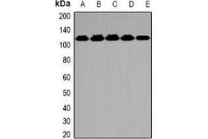 Image no. 3 for anti-O-Linked N-Acetylglucosamine (GlcNAc) Transferase (UDP-N-Acetylglucosamine:polypeptide-N-Acetylglucosaminyl Transferase) (OGT) antibody (ABIN2966858)