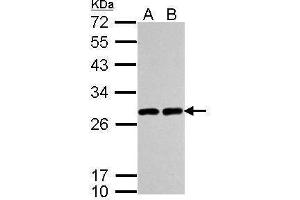 WB Image Sample (30 ug of whole cell lysate) A: A549 B: H1299 12% SDS PAGE antibody diluted at 1:5000