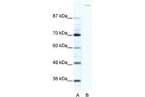 GLI1 antibody  (C-Term)