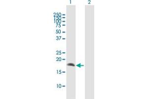 Image no. 1 for anti-Crystallin, gamma D (CRYGD) (AA 1-174) antibody (ABIN514639)