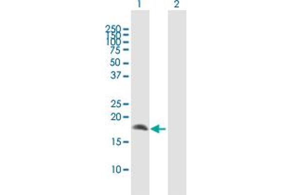 anti-Crystallin, gamma D (CRYGD) (AA 1-174) antibody