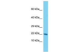 anti-Nudix (Nucleoside Diphosphate Linked Moiety X)-Type Motif 3 (NUDT3) (Middle Region) antibody