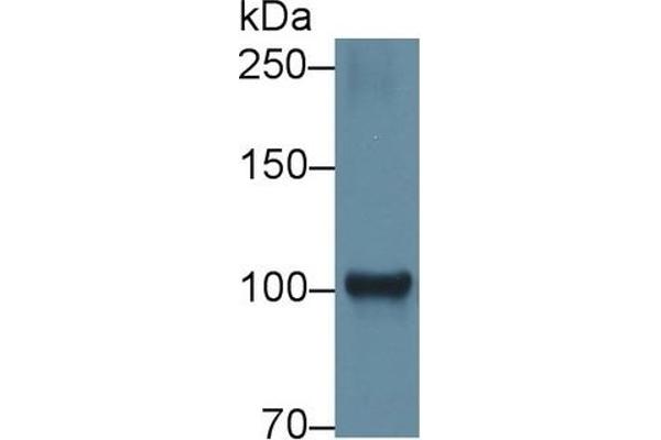 Hexokinase 1 antibody  (AA 413-540)