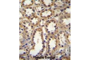 Image no. 1 for anti-Glypican 6 (GPC6) (AA 503-536), (C-Term) antibody (ABIN952557)