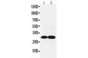 Image no. 1 for anti-Collagen, Type IV, alpha 2 (COL4A2) (AA 1697-1712), (C-Term) antibody (ABIN3042317)