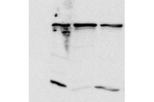 Image no. 1 for anti-Proteasome (Prosome, Macropain) 26S Subunit, Non-ATPase, 14 (PSMD14) antibody (ABIN108606)