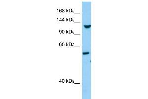 anti-Tolloid-Like 1 (TLL1) (C-Term) antibody