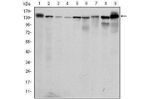 Image no. 4 for anti-Protein Kinase N2 (PKN2) antibody (ABIN1108660)