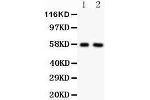 Image no. 3 for anti-Alkaline Phosphatase, Liver/bone/kidney (ALPL) (AA 21-35), (N-Term) antibody (ABIN3044314)