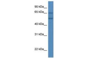 Image no. 1 for anti-Cytochrome P450, Family 2, Subfamily S, Polypeptide 1 (CYP2S1) (AA 319-368) antibody (ABIN6746052)