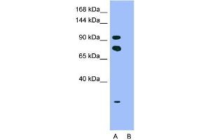 Image no. 8 for anti-Homeodomain Interacting Protein Kinase 2 (HIPK2) (Middle Region) antibody (ABIN2779735)