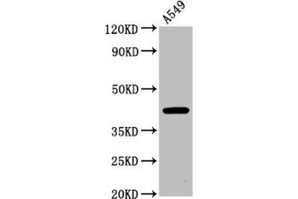 CHST14 antibody  (AA 70-133)