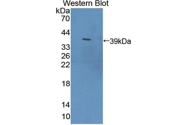 PDE12 antibody  (AA 290-602)
