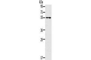 Gel: 8 % SDS-PAGE, Lysate: 40 μg, Lane: Mouse intestinum tenue tissue, Primary antibody: ABIN7192079(PUS10 Antibody) at dilution 1/200, Secondary antibody: Goat anti rabbit IgG at 1/8000 dilution, Exposure time: 3 seconds