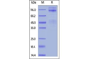 Image no. 2 for Insulin-Like Growth Factor 1 Receptor (IGF1R) (AA 31-936) protein (His tag) (ABIN6253547)