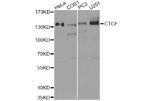 Image no. 2 for anti-CCCTC-Binding Factor (Zinc Finger Protein) (CTCF) antibody (ABIN3021507)