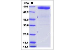 Image no. 1 for Gliomedin (GLDN) (AA 1-427) protein (Fc Tag,ECD) (ABIN2215530)