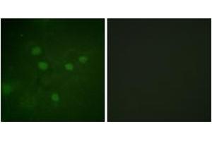 Immunofluorescence analysis of COS7 cells, using NFAT5 (Phospho-Ser1197) Antibody.