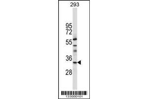 Image no. 1 for anti-TAF8 RNA Polymerase II, TATA Box Binding Protein (TBP)-Associated Factor, 43kDa (TAF8) (AA 151-178) antibody (ABIN657320)