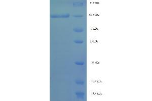 Image no. 1 for Septin 7 (SEPT7) (AA 2-437) protein (His-SUMO Tag) (ABIN5711293)