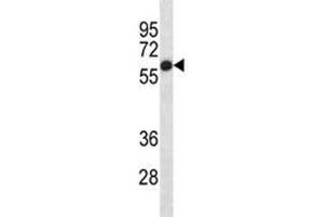 Image no. 4 for anti-Alkaline Phosphatase (ALP) (AA 56-83) antibody (ABIN3029911)