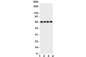 Western blot testing of PTH1R antibody and Lane 1:  SKOV;  2: U20S;  3: HeLa;  4: SMMC-7721 cell lysate;  Observed/expected size ~66KD