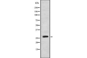 Western blot analysis of MOB2 using LOVO whole cell lysates