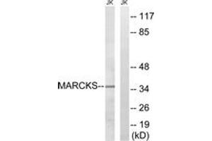 Image no. 1 for anti-Myristoylated Alanine-Rich Protein Kinase C Substrate (MARCKS) (AA 126-175) antibody (ABIN1532929)