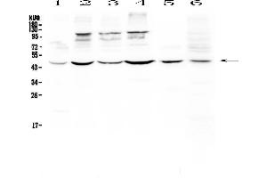 Image no. 1 for anti-CD209 (CD209) antibody (ABIN5693101)