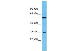 Image no. 1 for anti-Transmembrane Protease, serine 11E (TMPRSS11E) (N-Term) antibody (ABIN2791958)