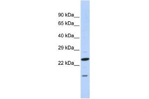 Image no. 1 for anti-Insulin Induced Gene 2 (INSIG2) (N-Term) antibody (ABIN635502)