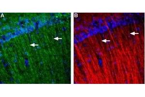 Expression of Galanin receptor 3 in rat hippocampus - Immunohistochemical staining of rat hippocampus using Anti-GALR3 (extracellular) Antibody (ABIN7043182, ABIN7044400 and ABIN7044401).