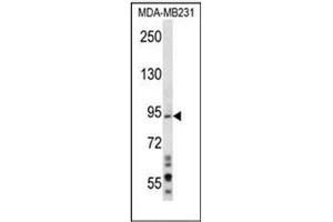 Image no. 1 for anti-MAD1 Mitotic Arrest Deficient-Like 1 (MAD1L1) (AA 131-159), (N-Term) antibody (ABIN953276)