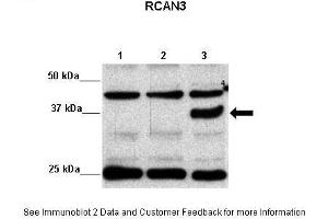 Image no. 2 for anti-RCAN Family Member 3 (RCAN3) (Middle Region) antibody (ABIN2779044)