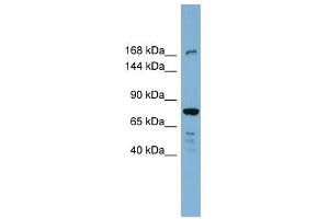 Image no. 1 for anti-Death-Associated Protein Kinase 1 (DAPK1) (N-Term) antibody (ABIN634506)