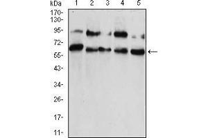 Image no. 1 for anti-Chromobox Homolog 2 (CBX2) (AA 402-525) antibody (ABIN5542421)