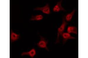 Image no. 2 for anti-serologically Defined Colon Cancer Antigen 1 (SDCCAG1) (C-Term) antibody (ABIN6259616)