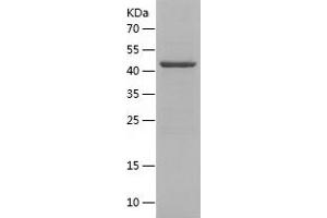 Nephrin Protein (AA 23-257) (His-IF2DI Tag)